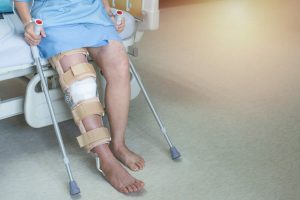 Best Physical Therapy Exercises After Knee Replacement Surgery