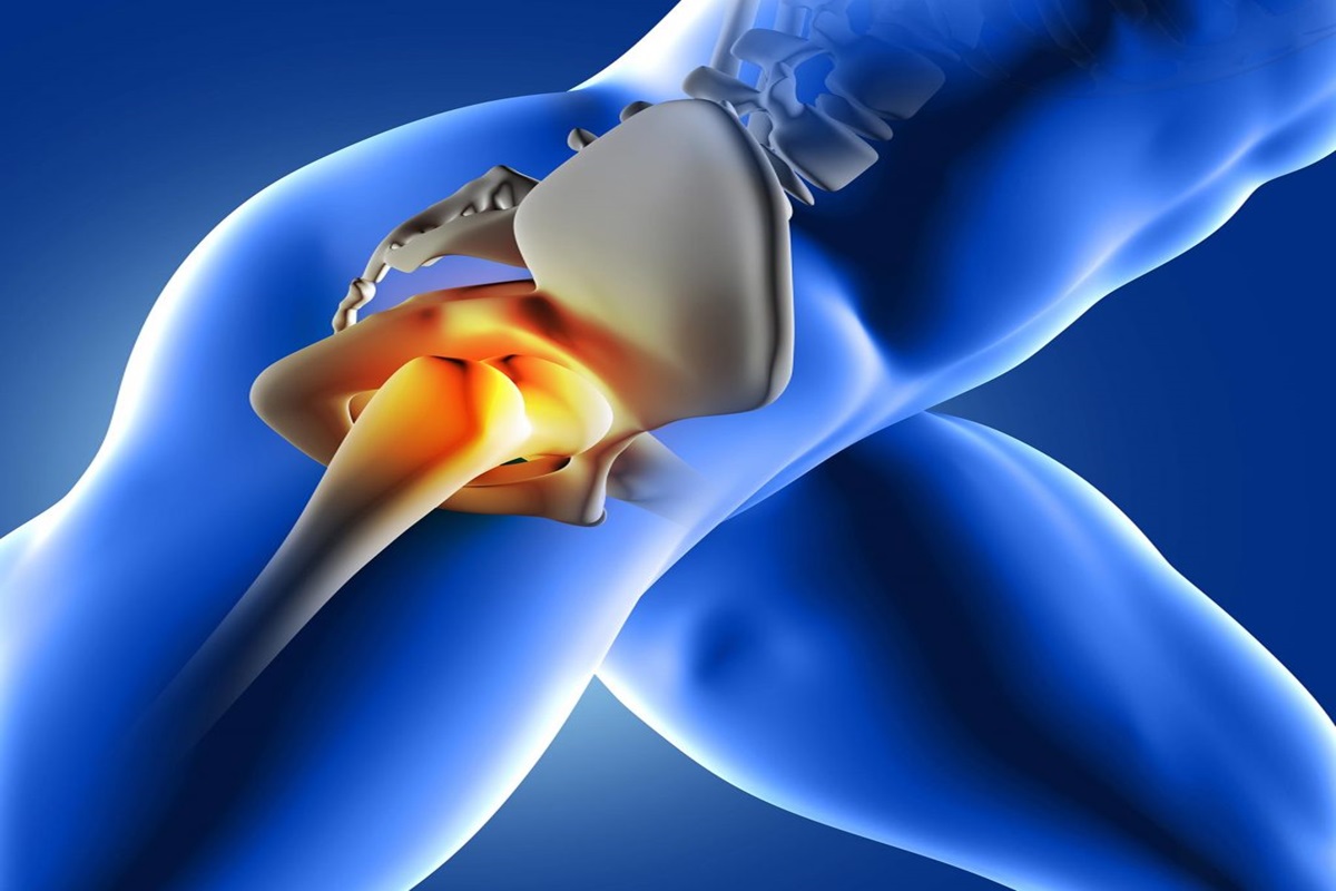 Hip Tendonitis