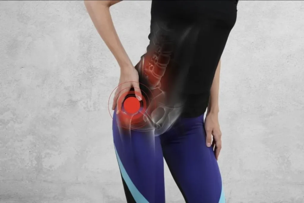 Woman holding her hip with a red pain highlight showing burning pain in hip near the hip joint.