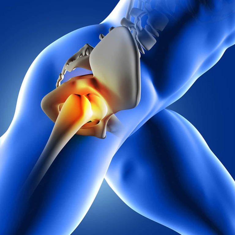 Hip Labral Tear Symptoms, Causes, Treatment (2)